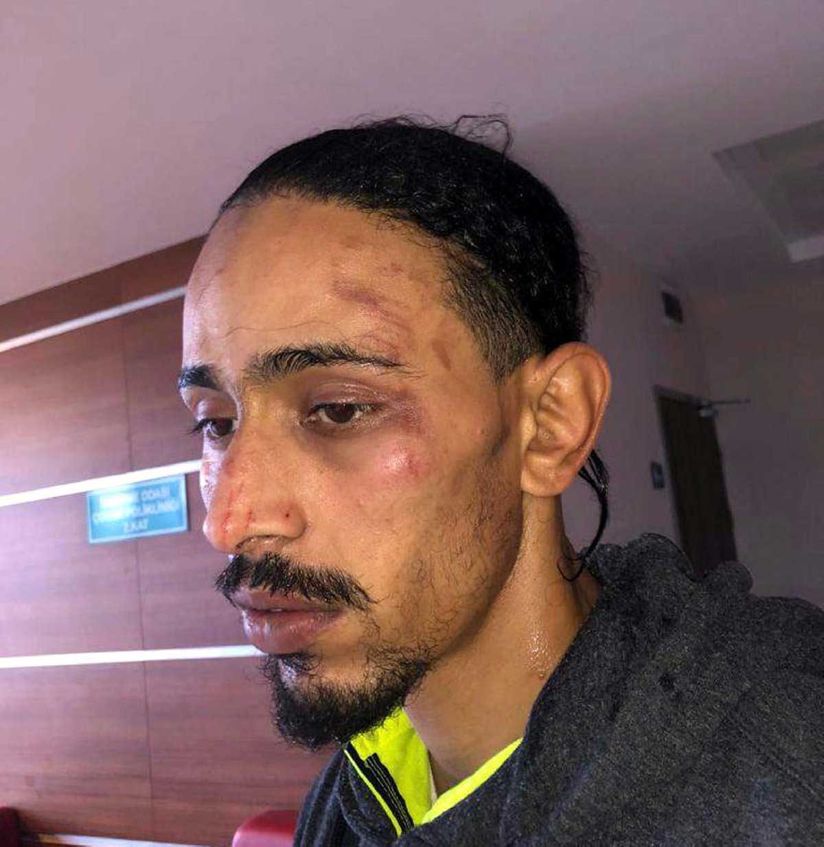 Photos. Grèce: des migrants marocains extorqués, torturés et repoussés vers la Turquie