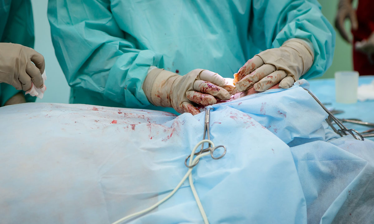 Trafic d'implants cardiaques: enquête en Roumanie sur des prélèvements frauduleux sur des morts
