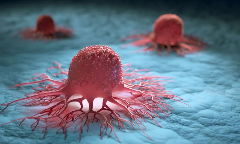 Tumeur cancer