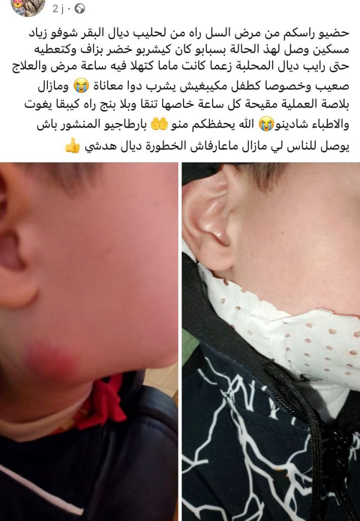 post fb